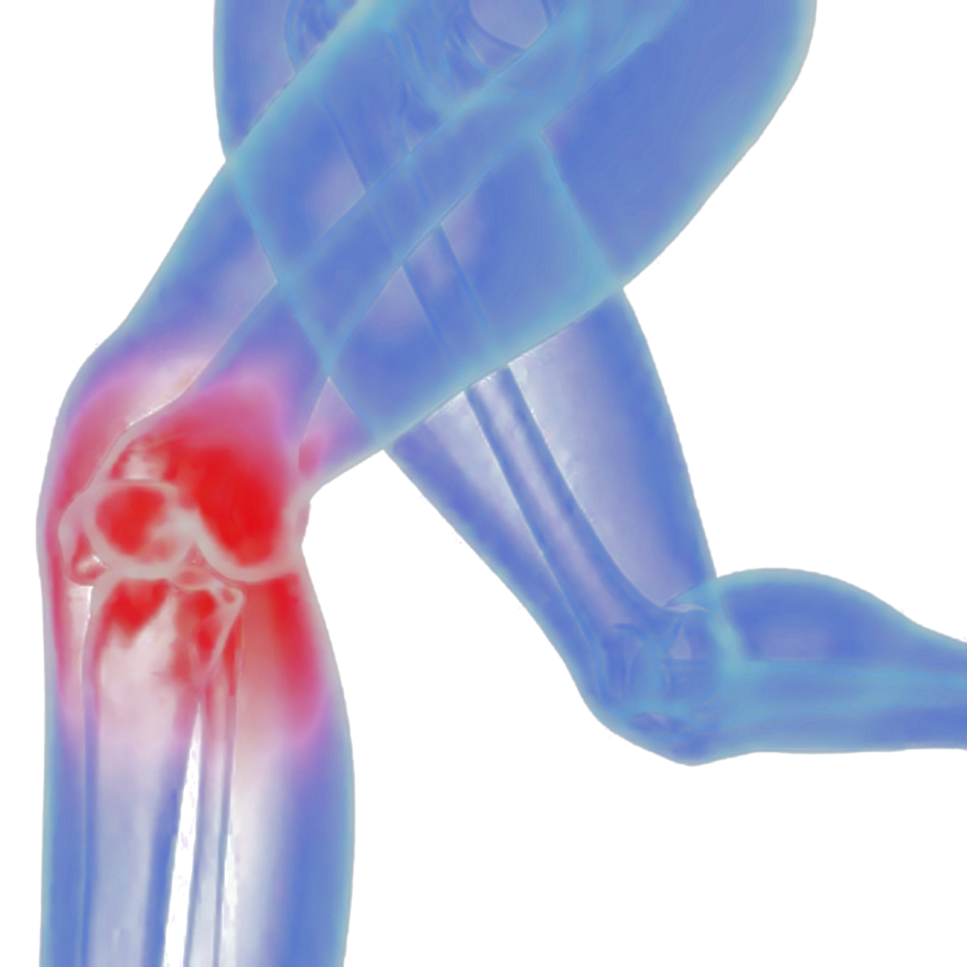 Ginocchio con dolore, immagine radiografica stilizzata